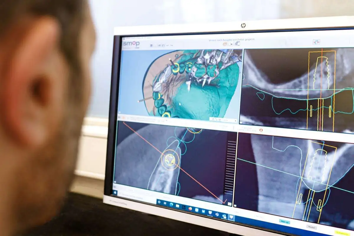 Digitale Auftragsdaten am Bildschirm im Dentallabor
